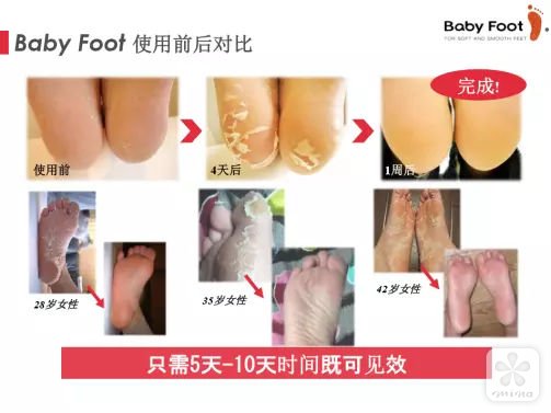 女王foot