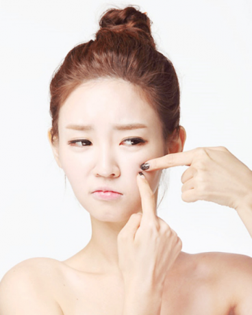 创尔美愈活肌诊室﹐解文老师教你巧祛痘 _时话