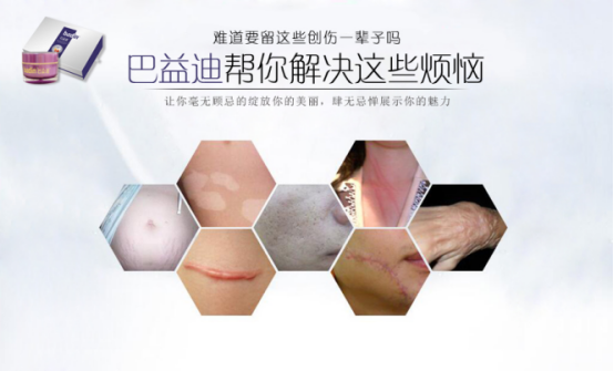 f44d305ea4881aa9eb1e50.png